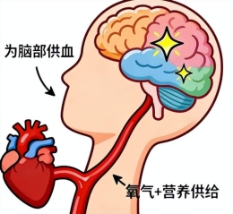 给血管拍张“高清照”，脑梗风险早知道！