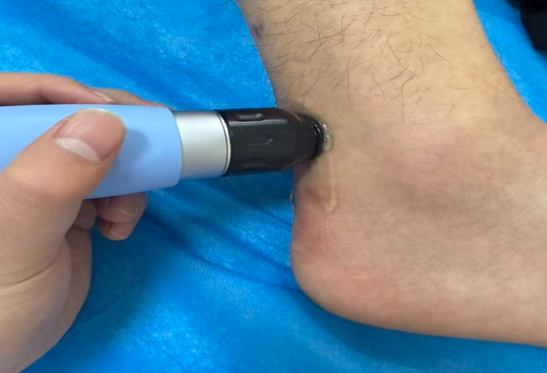 那个“侧身走”的人，跑起来了!