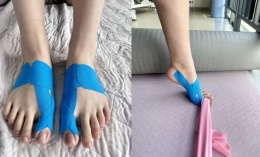 她们曾穿鞋痛、怕下楼、抬脚难，直到...