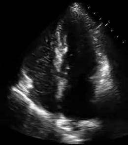 偏头痛十几年，根源竟然在“心里”？