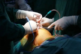 我只是坚持跑步，怎么就膝关节损伤了？