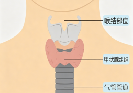 甲状腺疾病为何偏偏“重女轻男”？