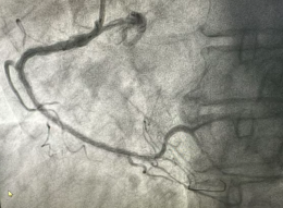 这场“护心”赛跑，赢了！