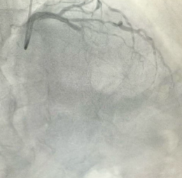 手术后，他的“心脏养护”才刚刚开始