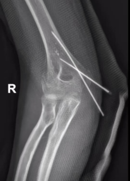 这份特别的“礼物”，谢主任收到了 ！